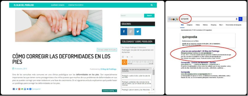 El Blog del Podólogo